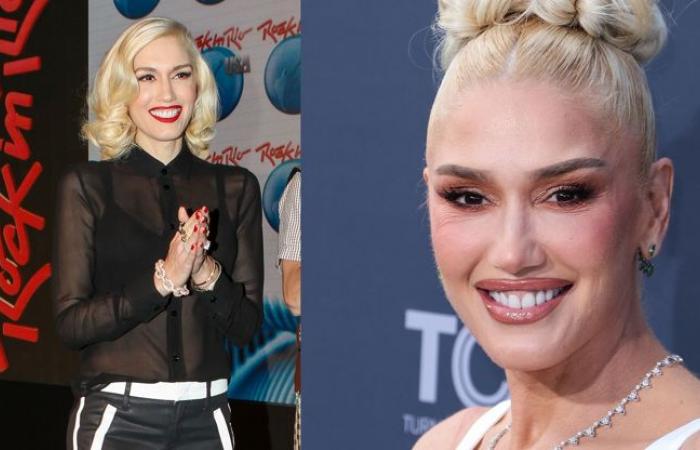 Gwen Stefani fell for plastic surgery. Fans are confused by her transformation – eXtra.cz