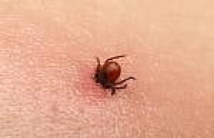 The only correct procedure to remove the tick. It is also approved by rescuers