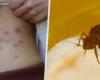 Regio Jet train: A couple was bitten by bedbugs on the way from Prague